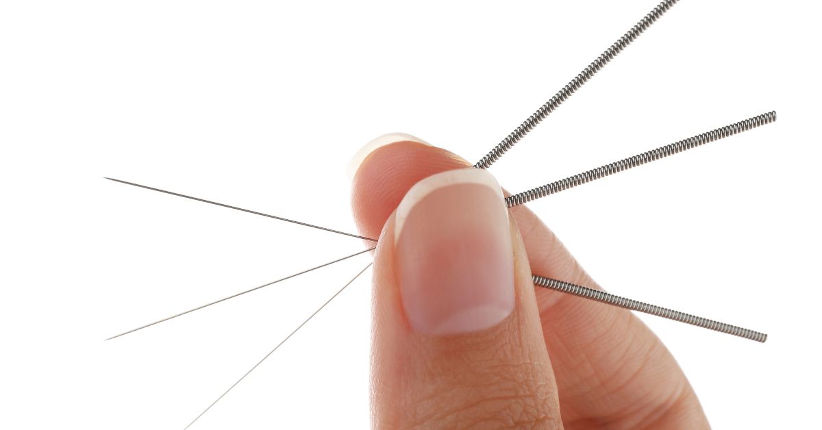 How Does Energy Healing Differ from Acupuncture?